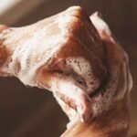 Hygiene hypothesis